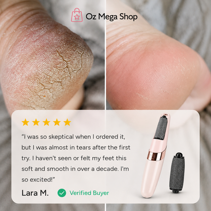 VelFeet - Leaves Feet Smooth, Soft & Sandal-Ready