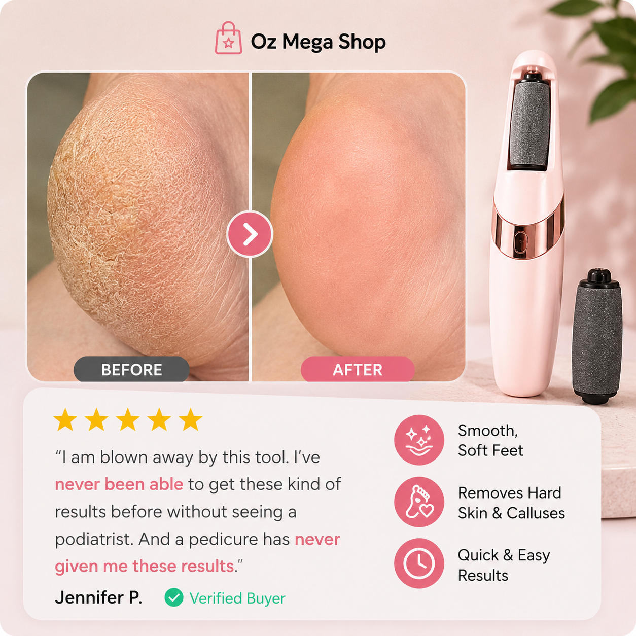 VelFeet - Leaves Feet Smooth, Soft & Sandal-Ready